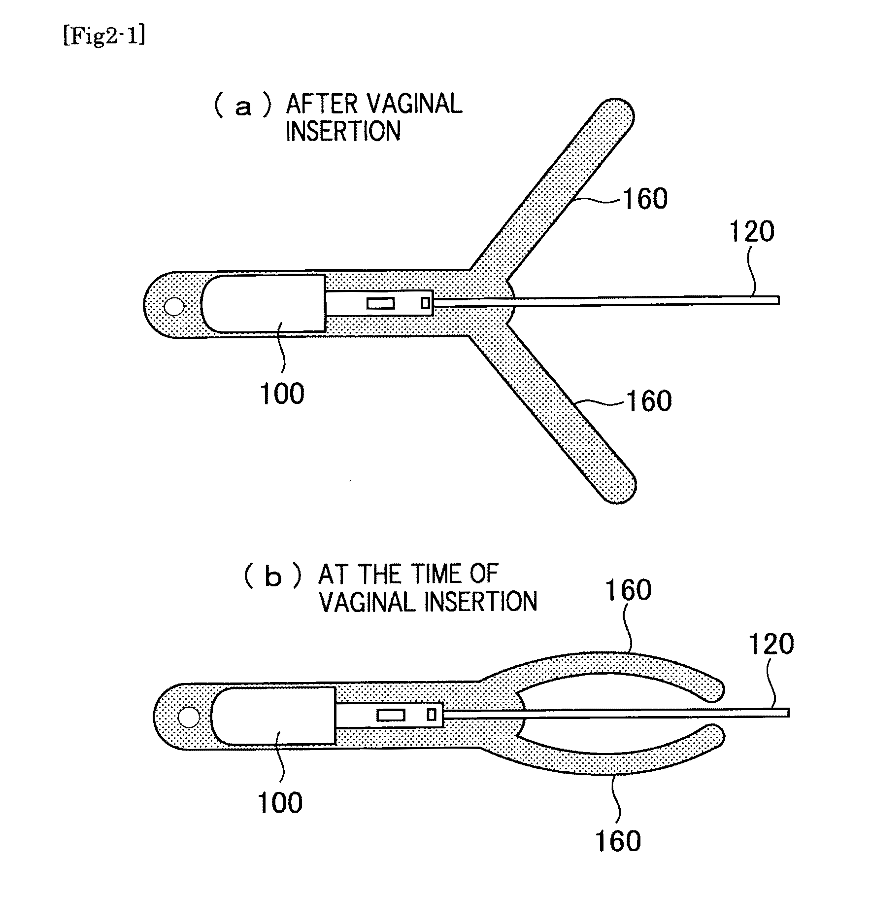 Birth Prediction Reporting System for Live Stock Animals