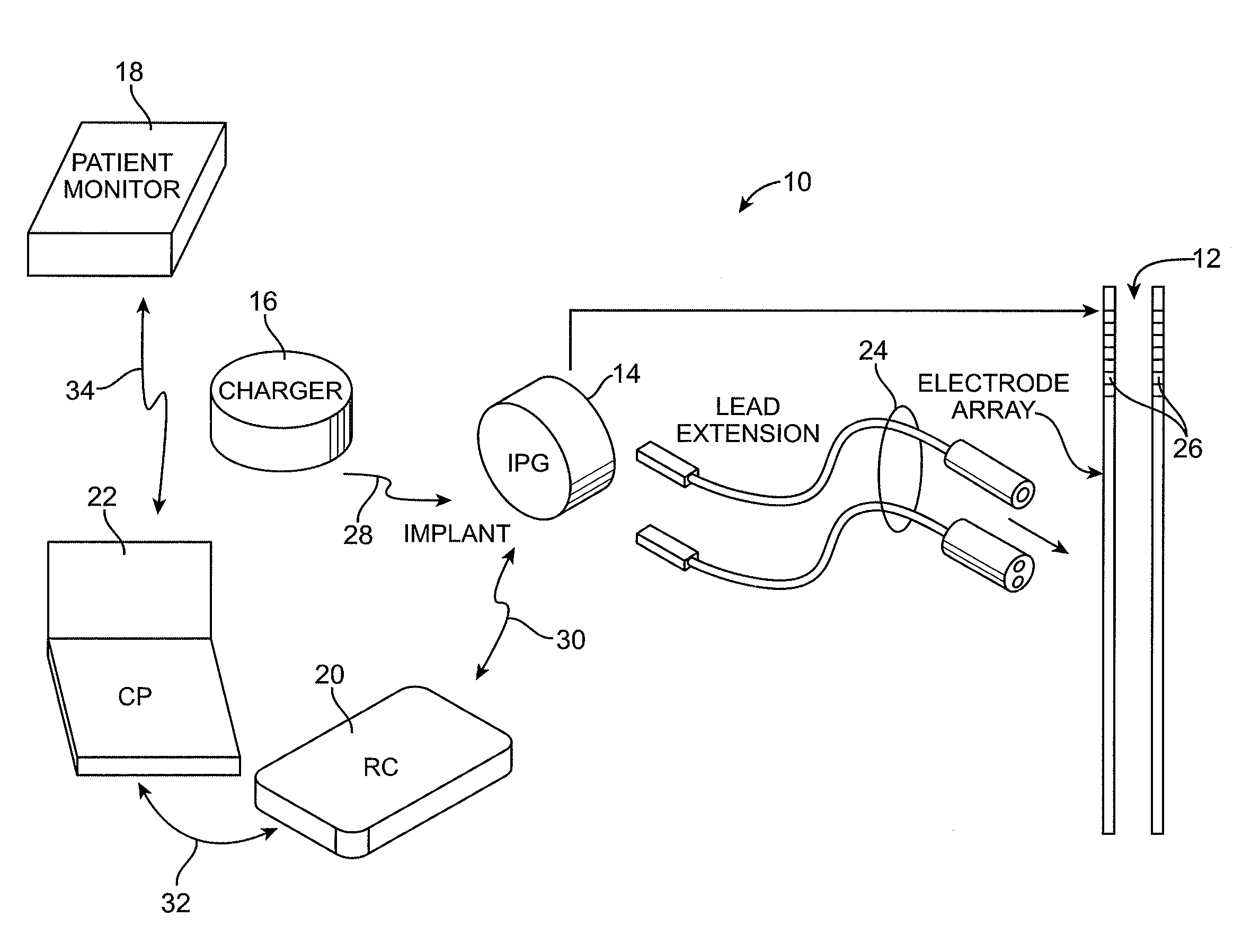 Automated fitting system for deep brain stimulation