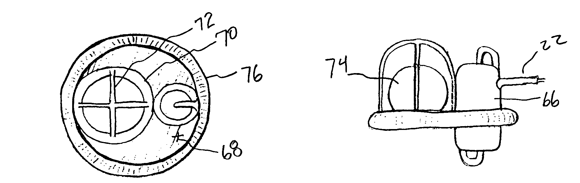 Minimally invasive transvalvular ventricular assist device