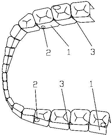 Desensitization reagent fixing device for treating dentin hypersensitivity as well as preparation method and forming method of fixing device