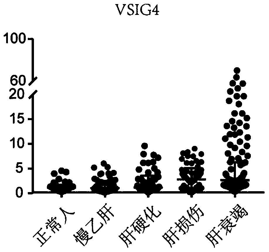 Novel application of VSIG4 in diagnosis of hepatic failure, kit and application of kit for diagnosing hepatic failure