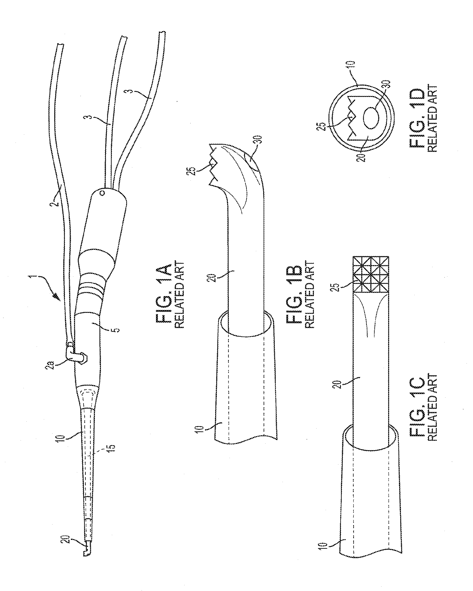 Modified ultrasound aspirator for use in and around vital structures of a body