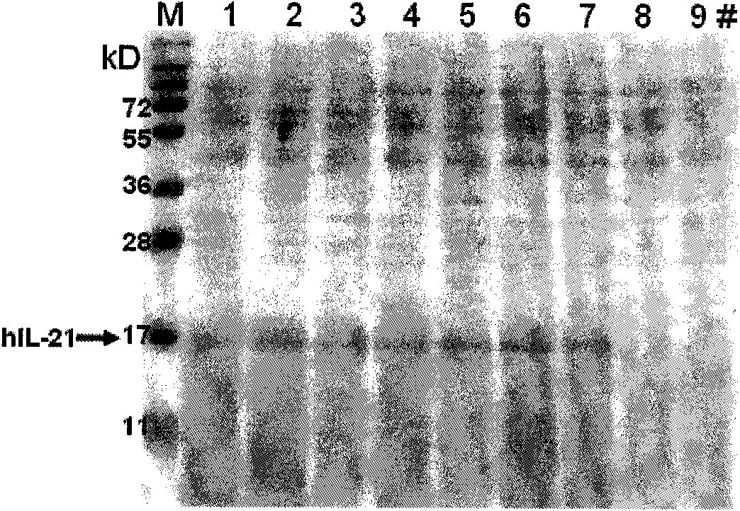 Method for producing recombinant human interleukin-21 by using Pichia pastoris