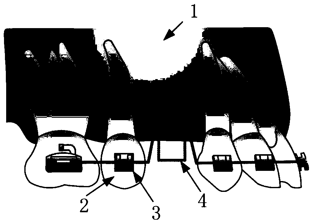 Method for establishing closed-gap box-shaped curve orthodontic force prediction model