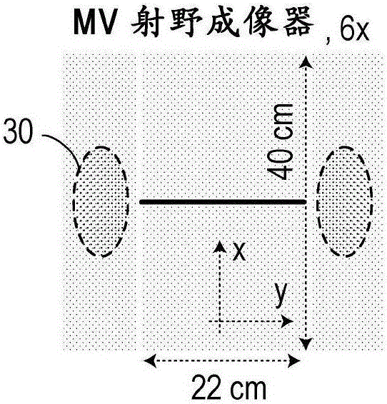 Multileaf collimator assembly with reduced extra-focal leakage