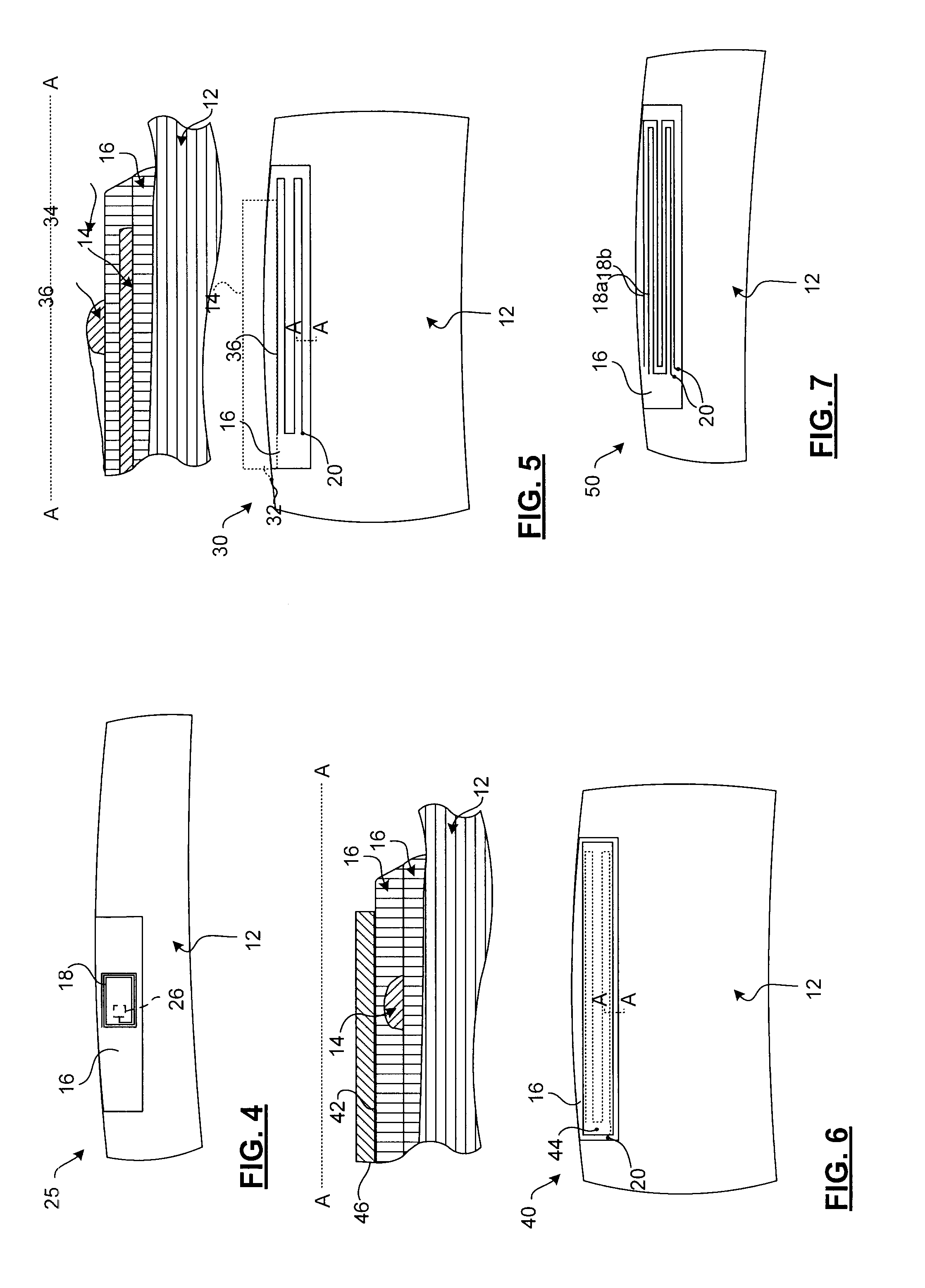 Surface-Mounted Crack Detection