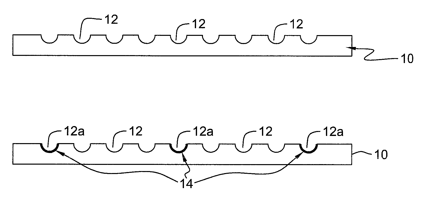 High-temperature alloy standoffs for injection molding of solder