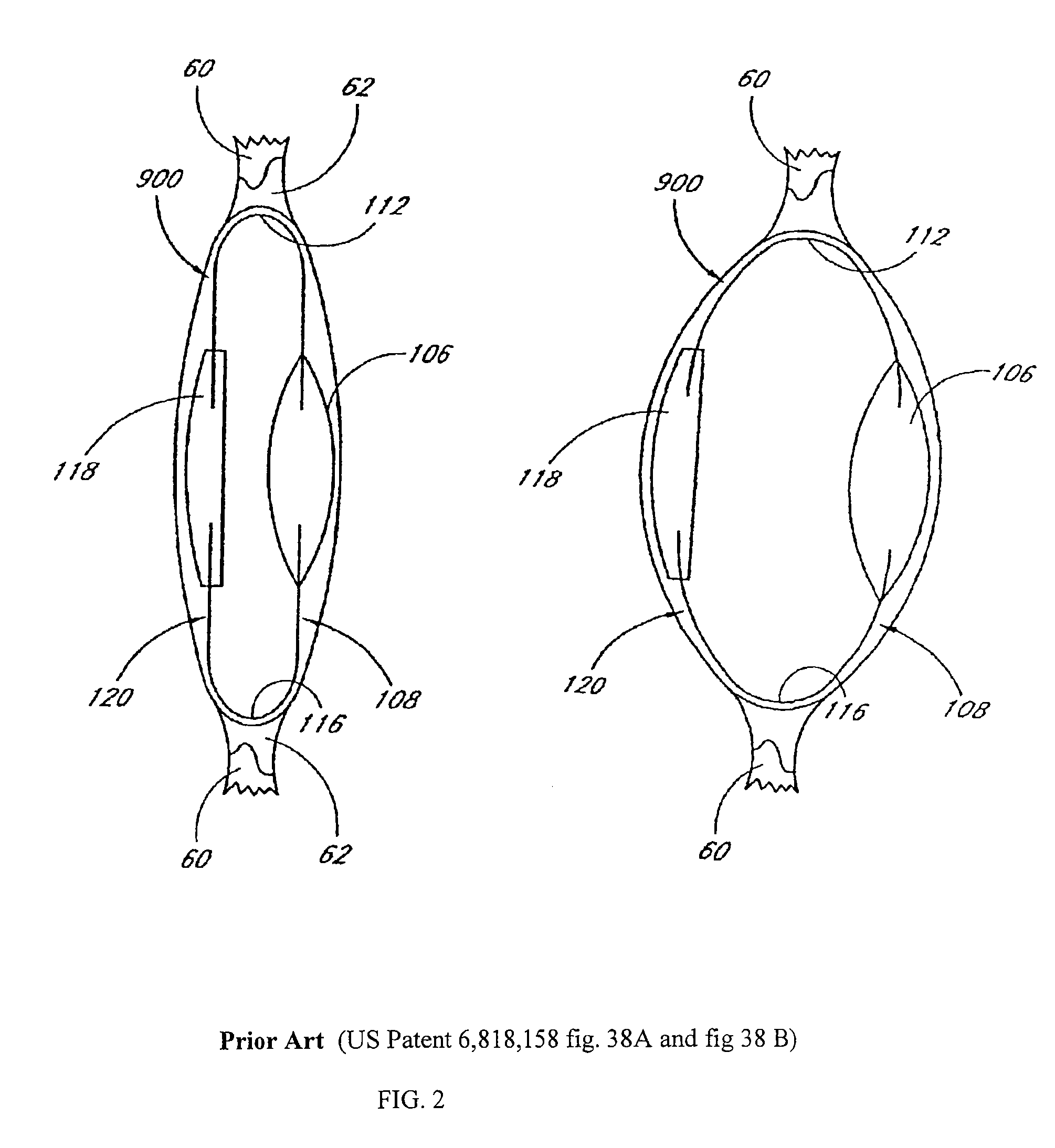 Accommodative intraocular lens system