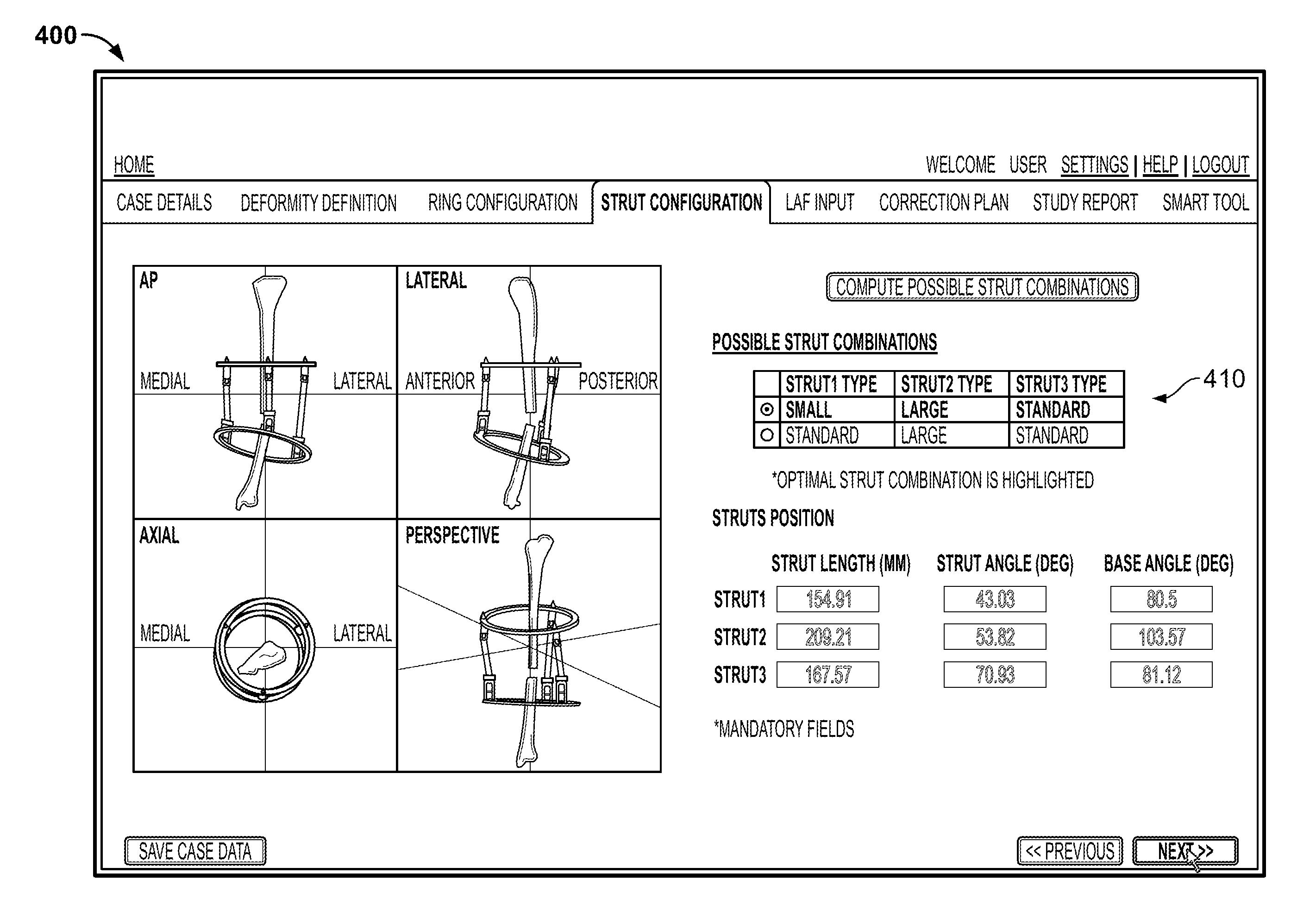 Software for use with deformity correction