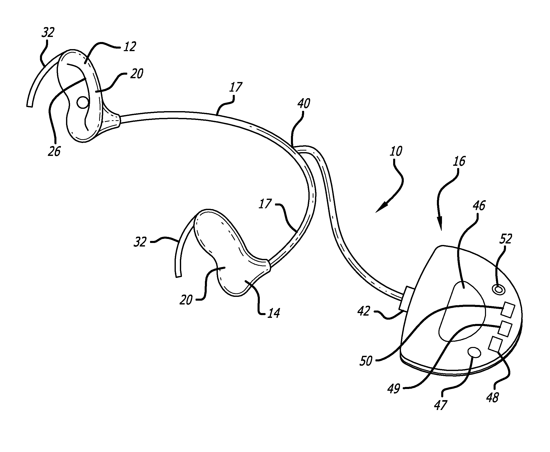 Mastoid ear cuff and system