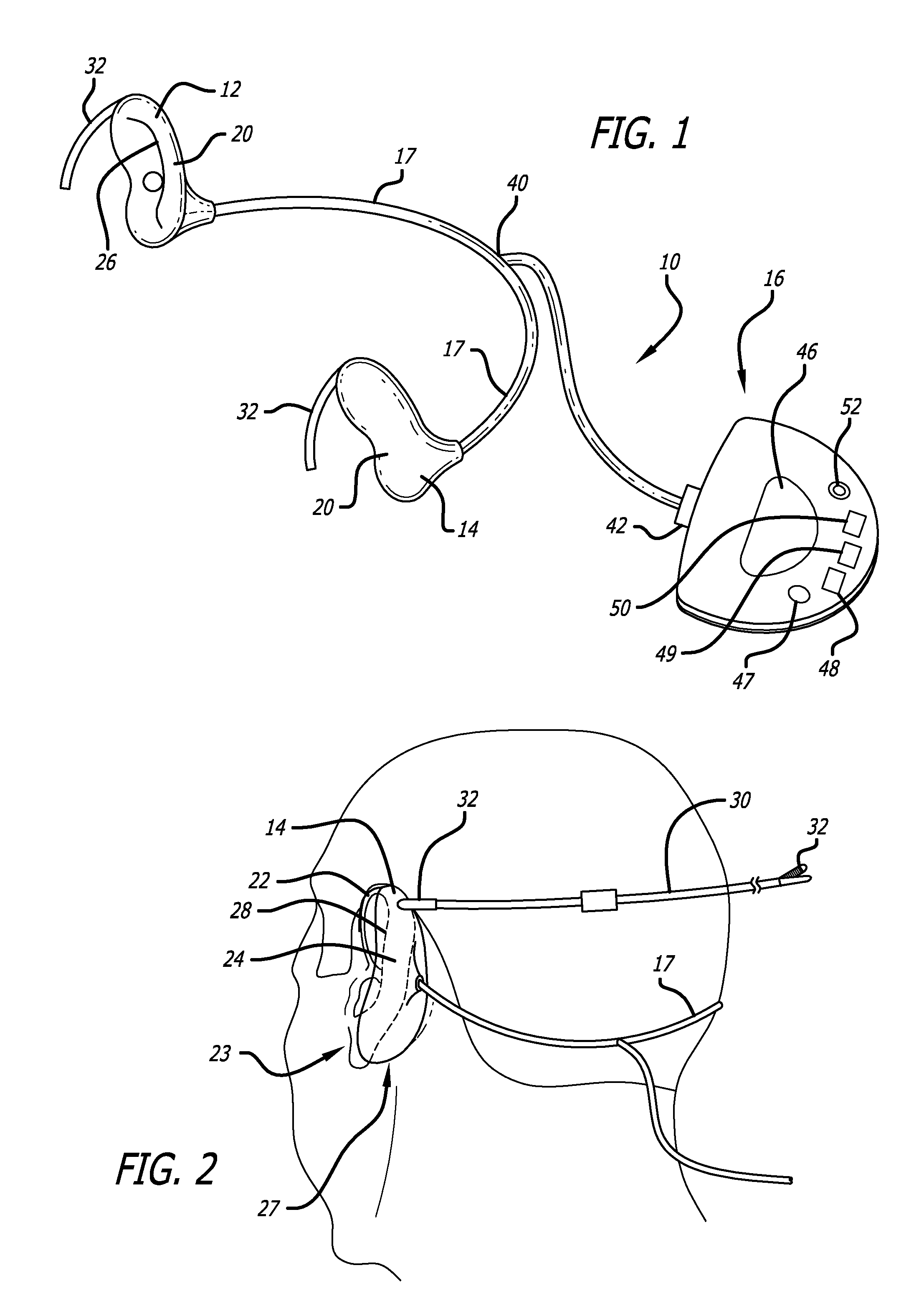 Mastoid ear cuff and system