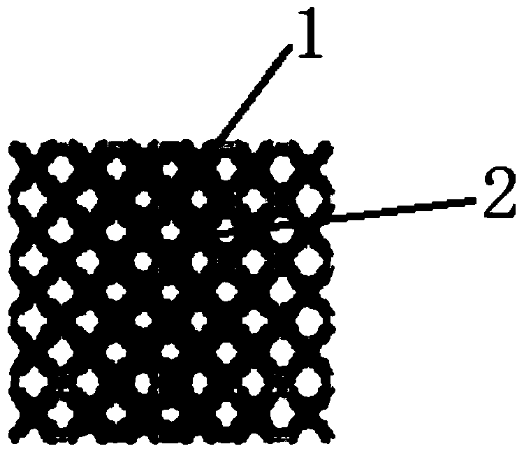 Metal bone trabecula and bone implant comprising metal bone trabecula