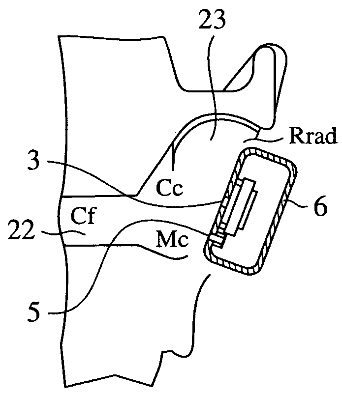 Portable accoustic apparatus