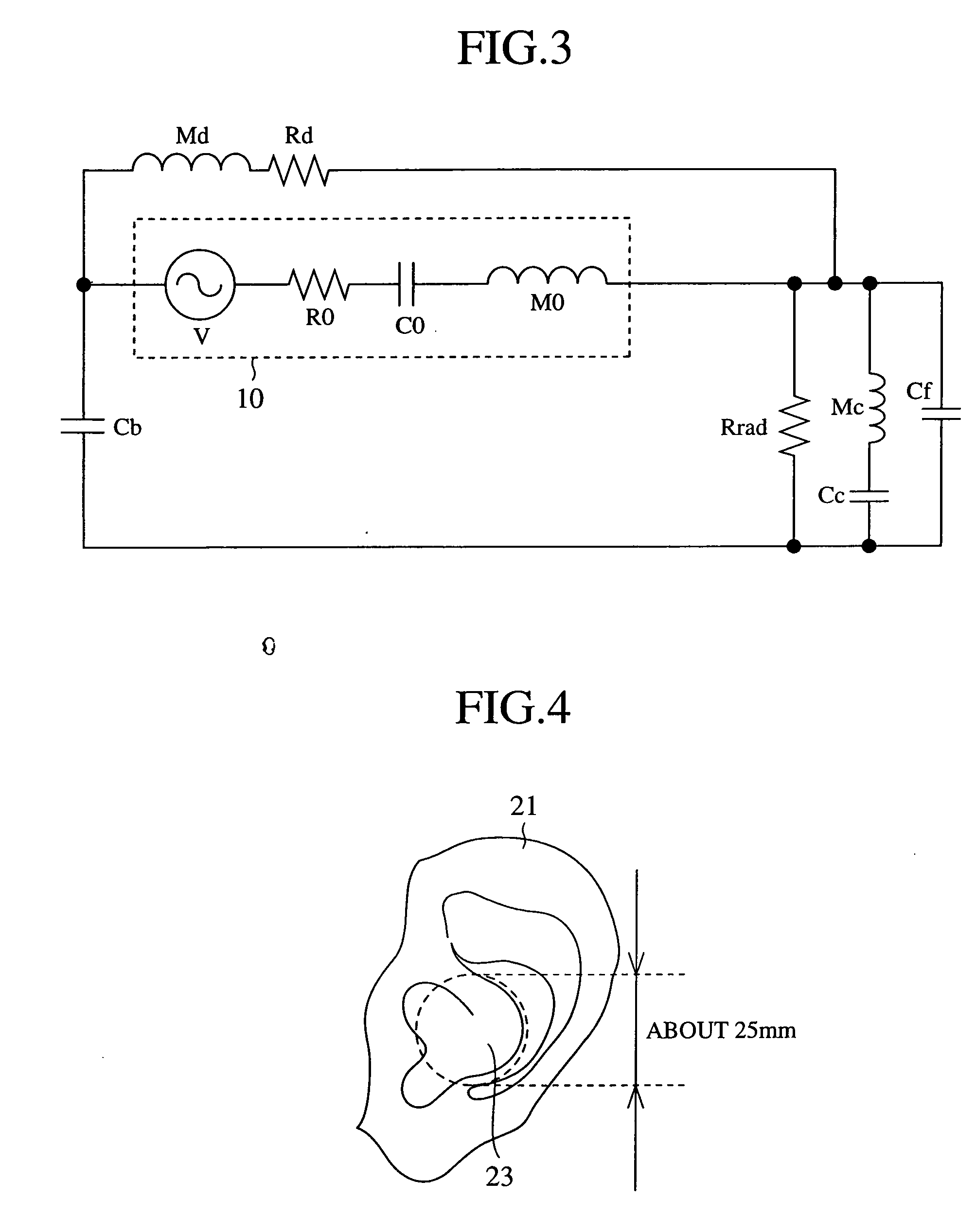 Portable accoustic apparatus