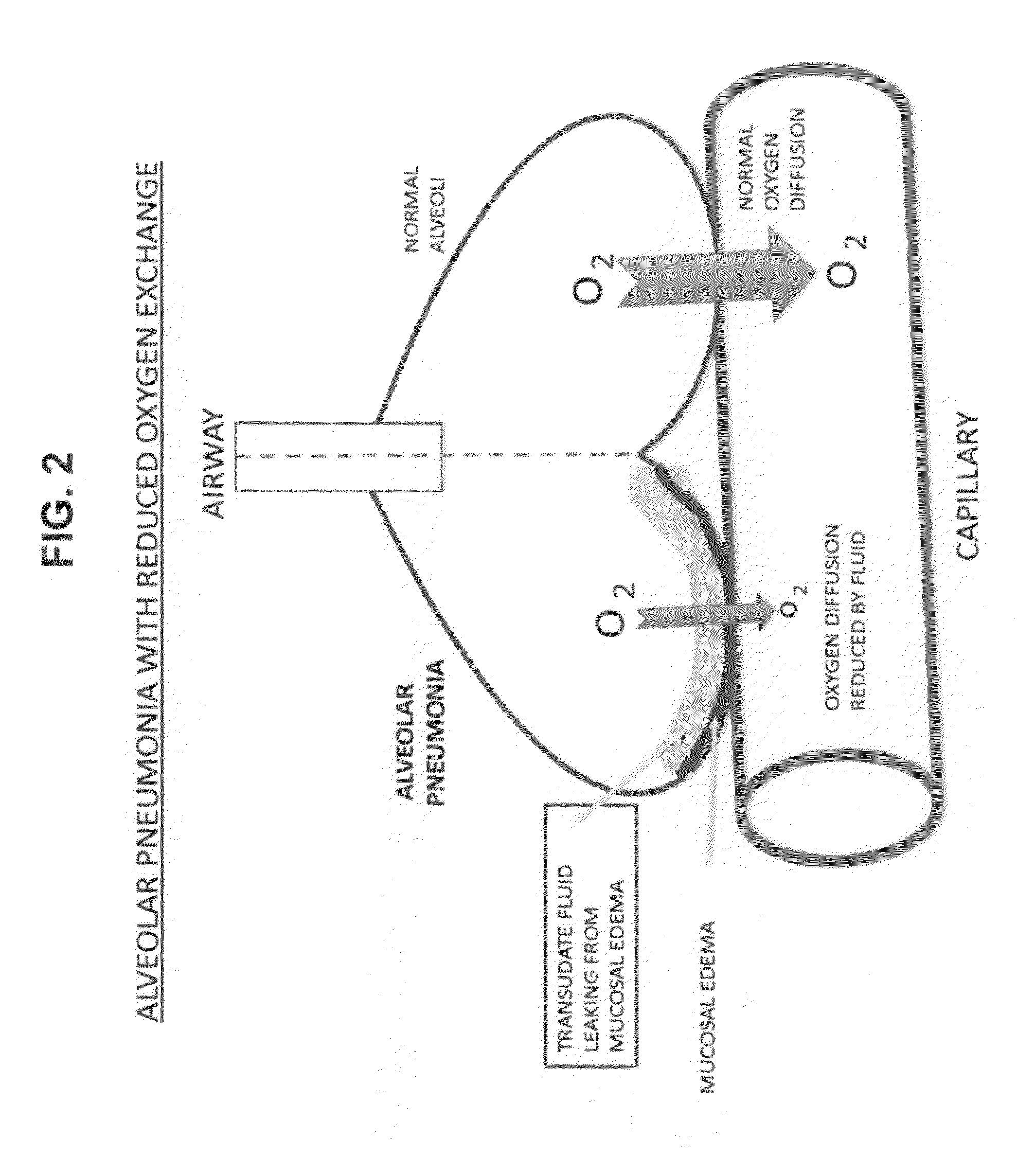 Compositions and methods for treatment of pulmonary diseases and conditions