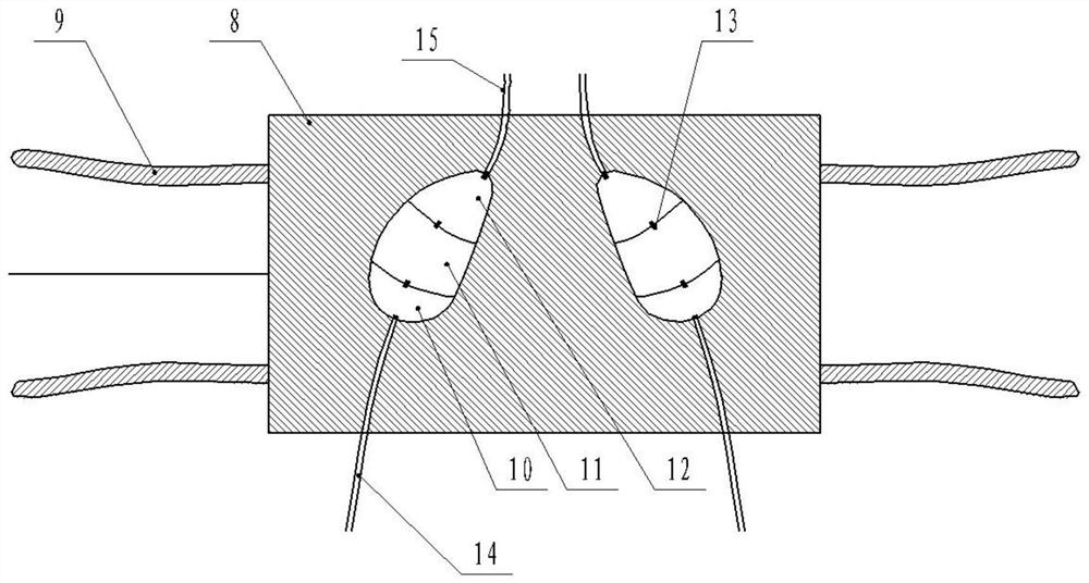 A device based on a vibration source to assist in the removal of children's lung secretions