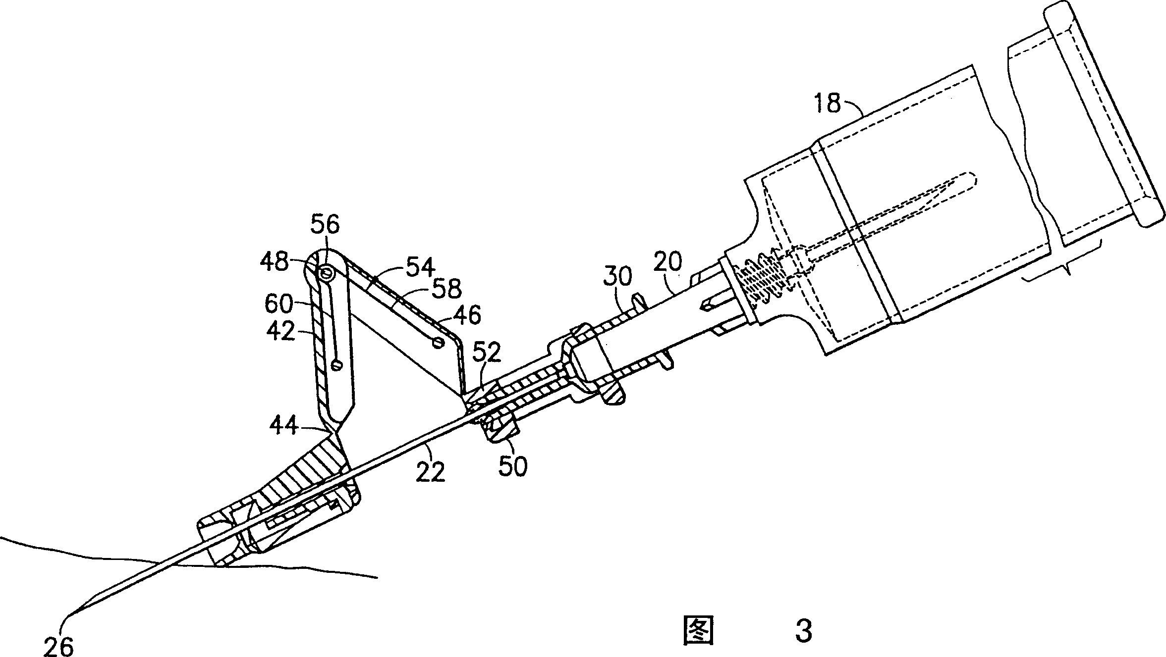 Passively-driven safe needle