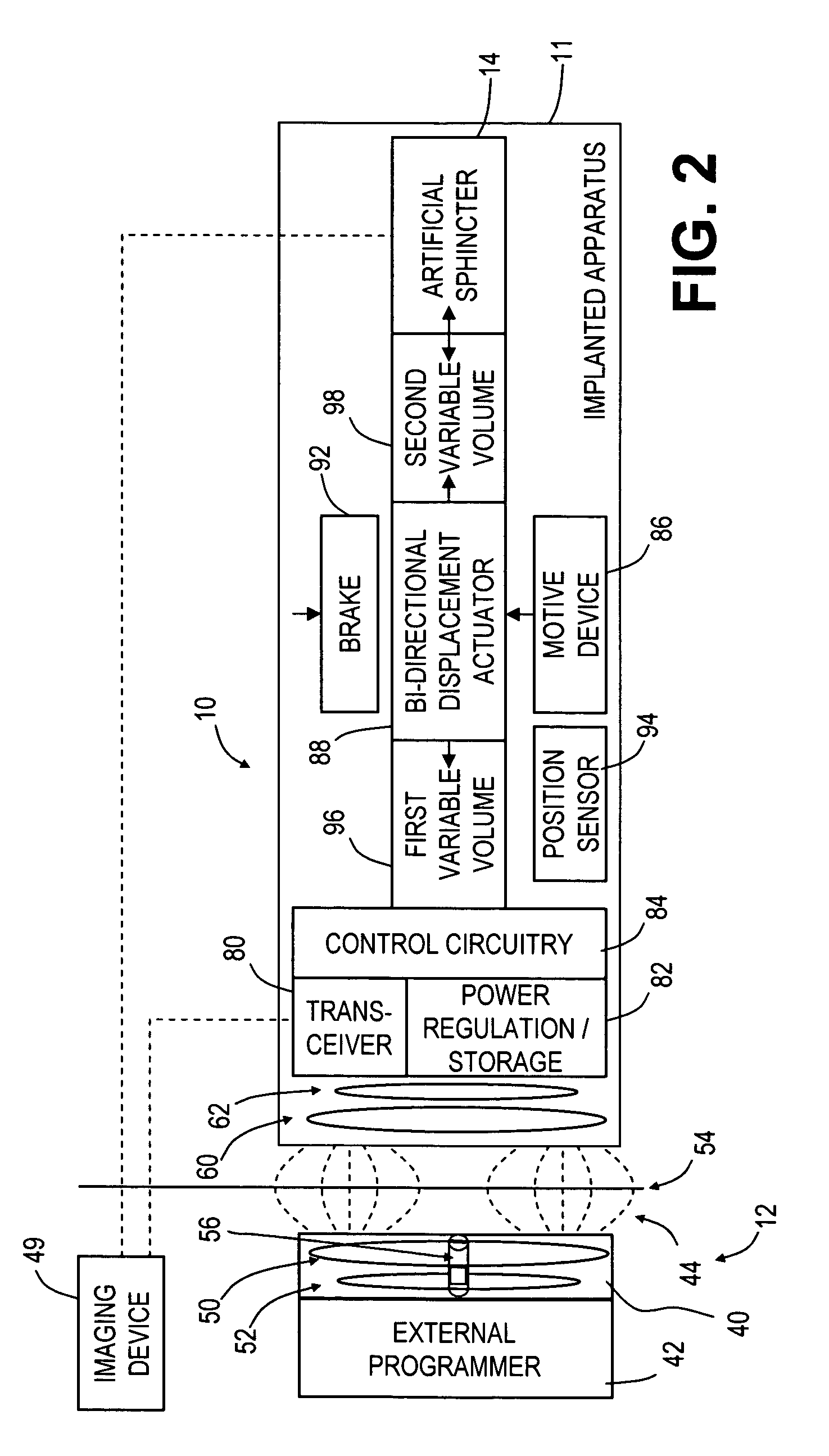 Magnetic resonance imaging (MRI) safe remotely adjustable artifical sphincter