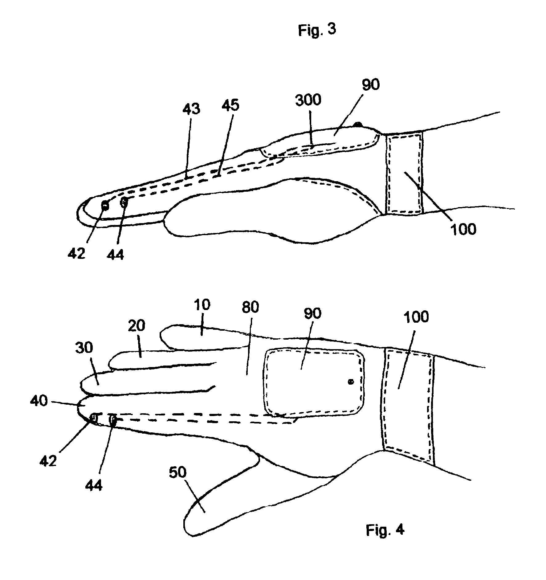 Versatile stun glove