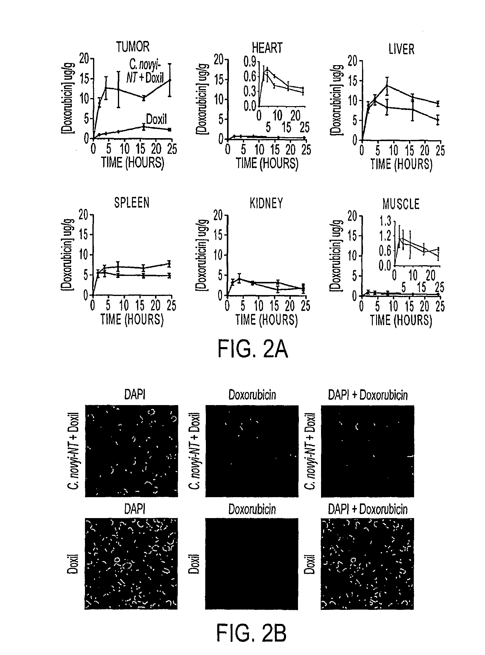 Tumor specific delivery of therapeutic agents via liposomase