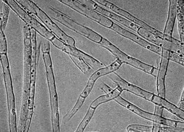 Monascus rubber Mr-99 strain and its application