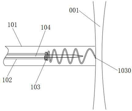 Atrial shunt device