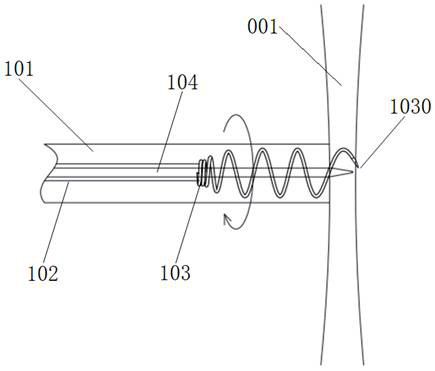 Atrial shunt device