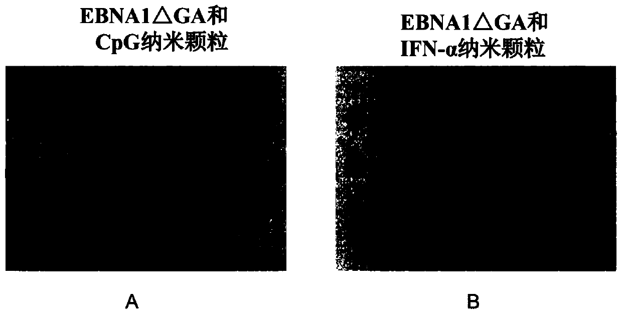 Subunit nano vaccine for preventing and treating nasopharyngeal carcinoma and preparation method of subunit nano vaccine