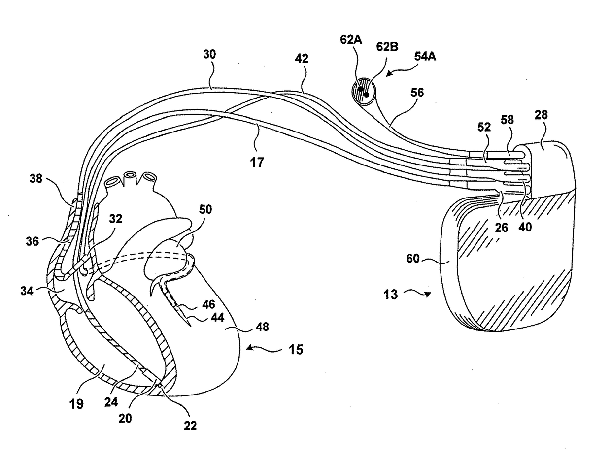 Method and device to monitor patients with kidney disease