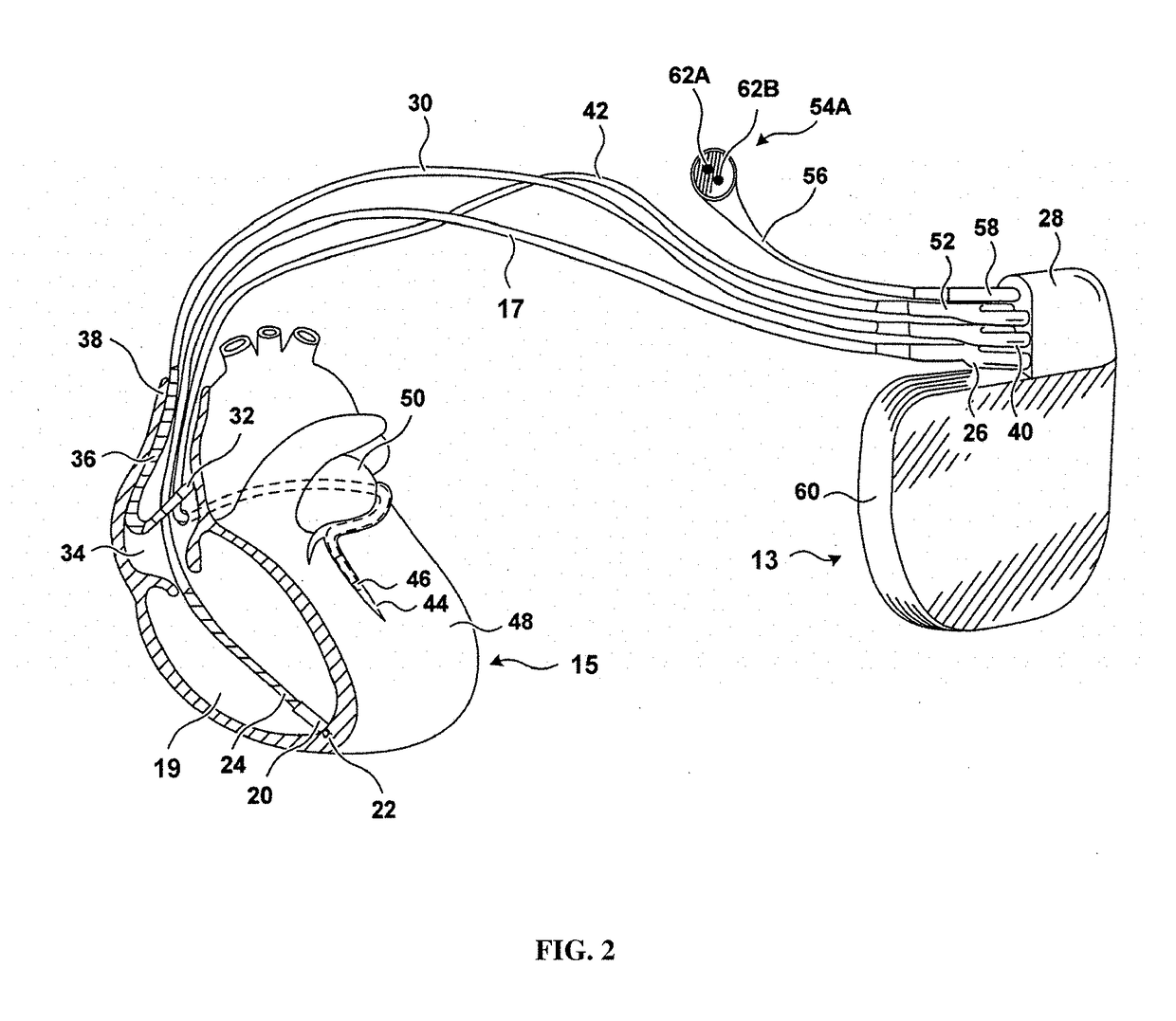 Method and device to monitor patients with kidney disease