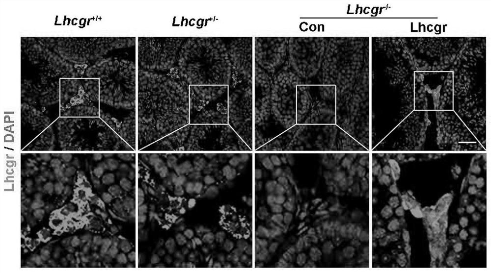 Gene medicine for treating testicular interstitial cell dysfunction and application thereof