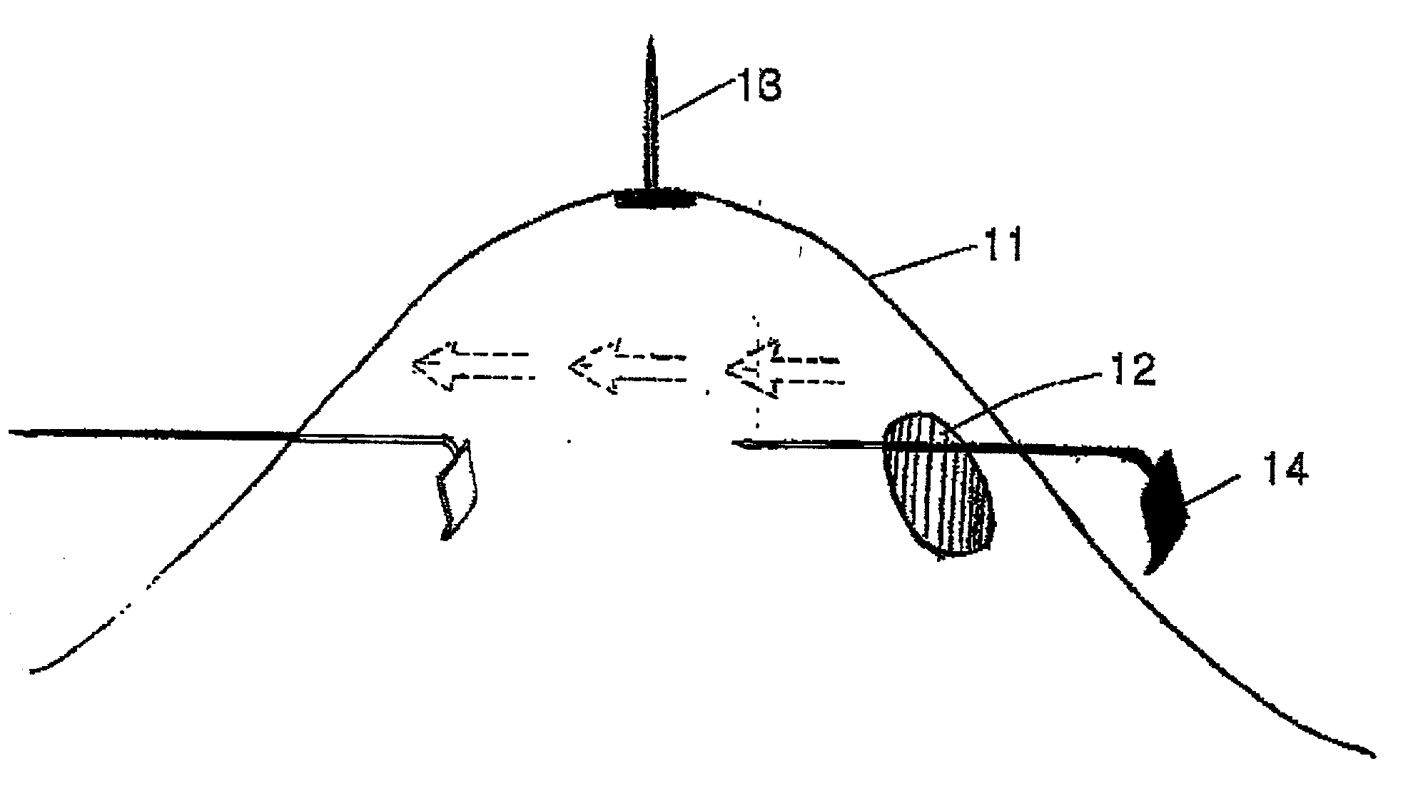 Surgical instruments and method for creating anatomic working space in minilaparotomy procedure