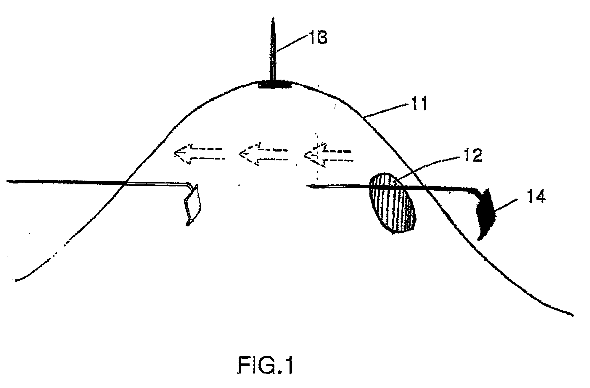 Surgical instruments and method for creating anatomic working space in minilaparotomy procedure