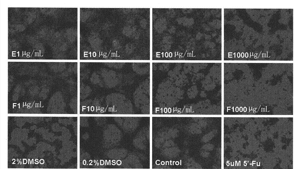 Application of ranunculus japonicus extract in preparing anti-tumor and anti-tumor angiogenesis drugs