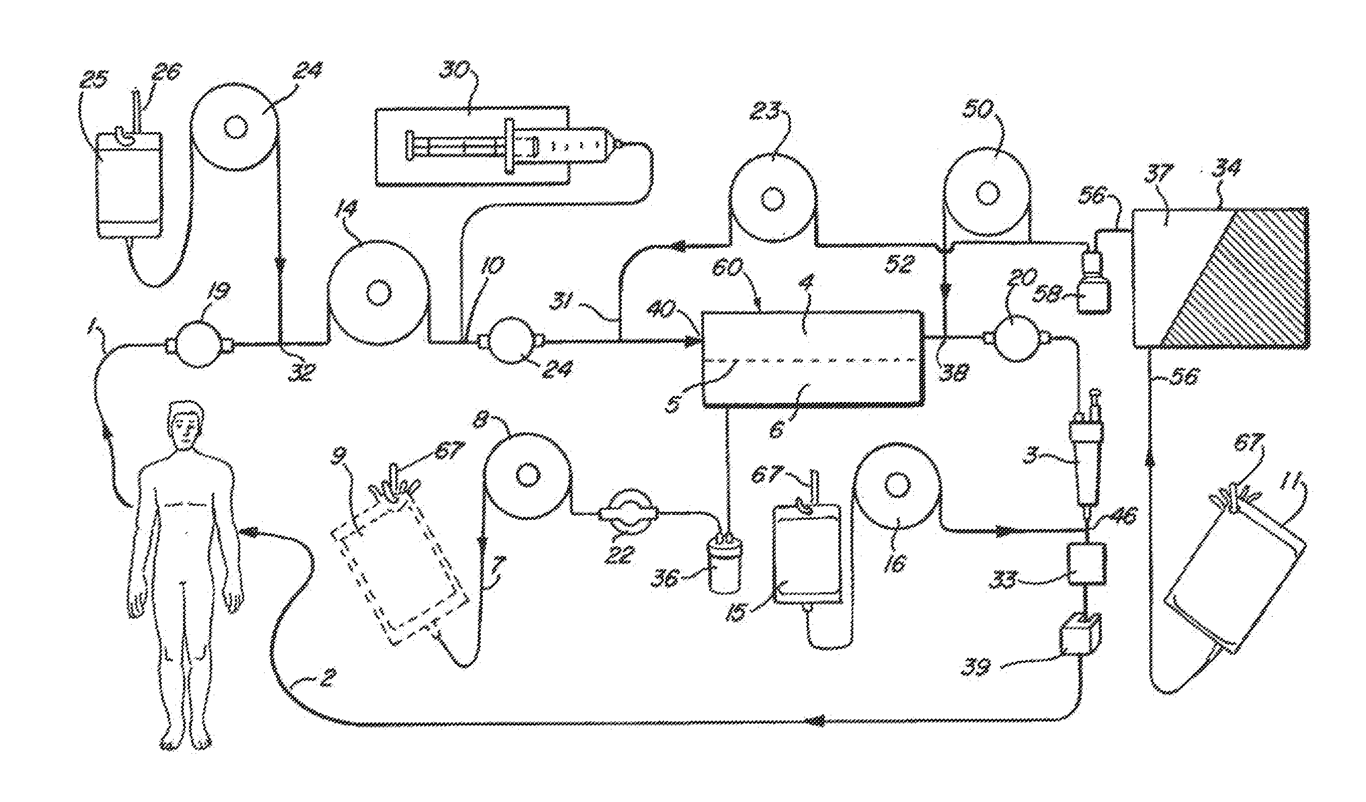 Citrate anticoagulation system for extracorporeal blood treatments