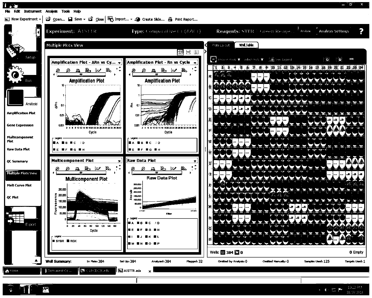 Establishing method and application for multi-gene liver cancer prognosis grading system