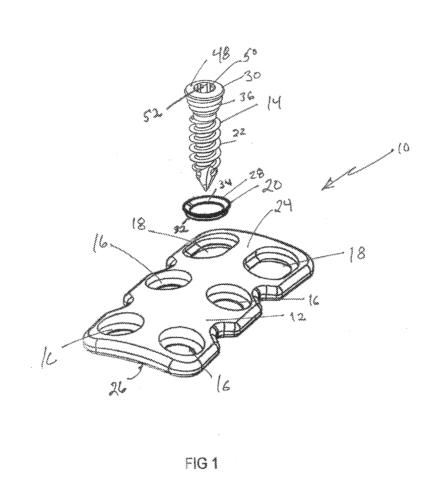 Dynamic anterior vertebral plate