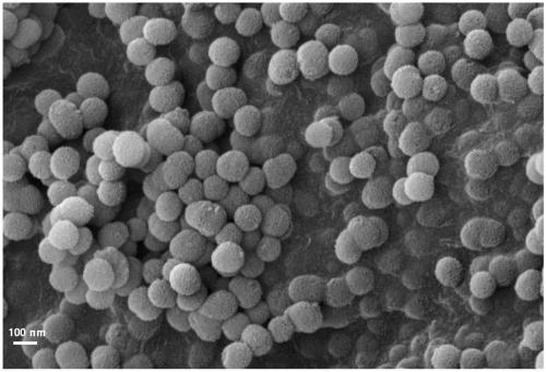 Micro-nano bioactive glass micro-sphere with high calcium and phosphorus content and preparation method of micro-sphere