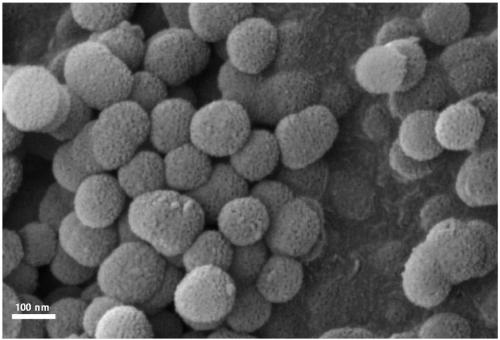 Micro-nano bioactive glass micro-sphere with high calcium and phosphorus content and preparation method of micro-sphere