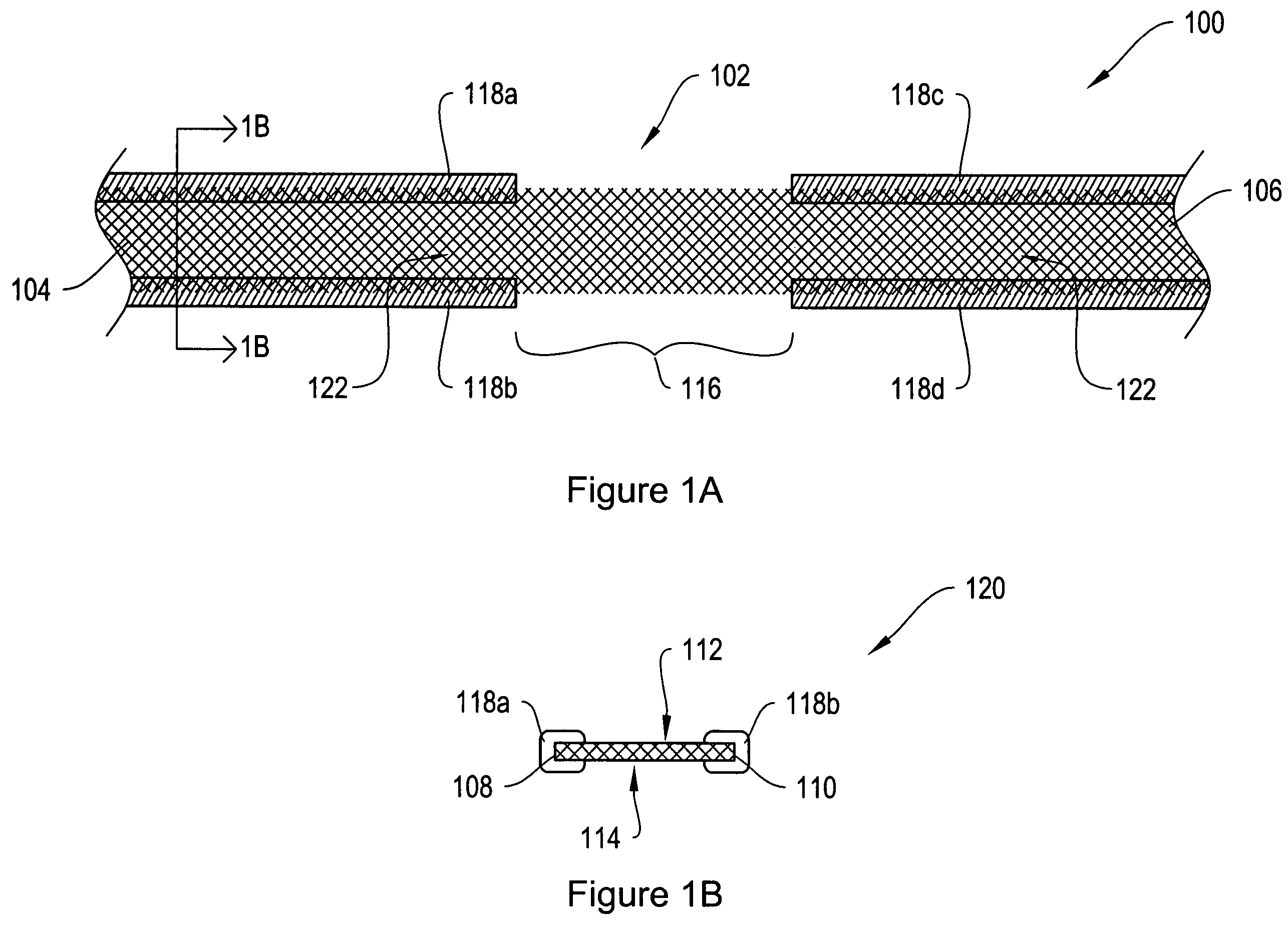 Dissolvable protective treatment for an implantable supportive sling