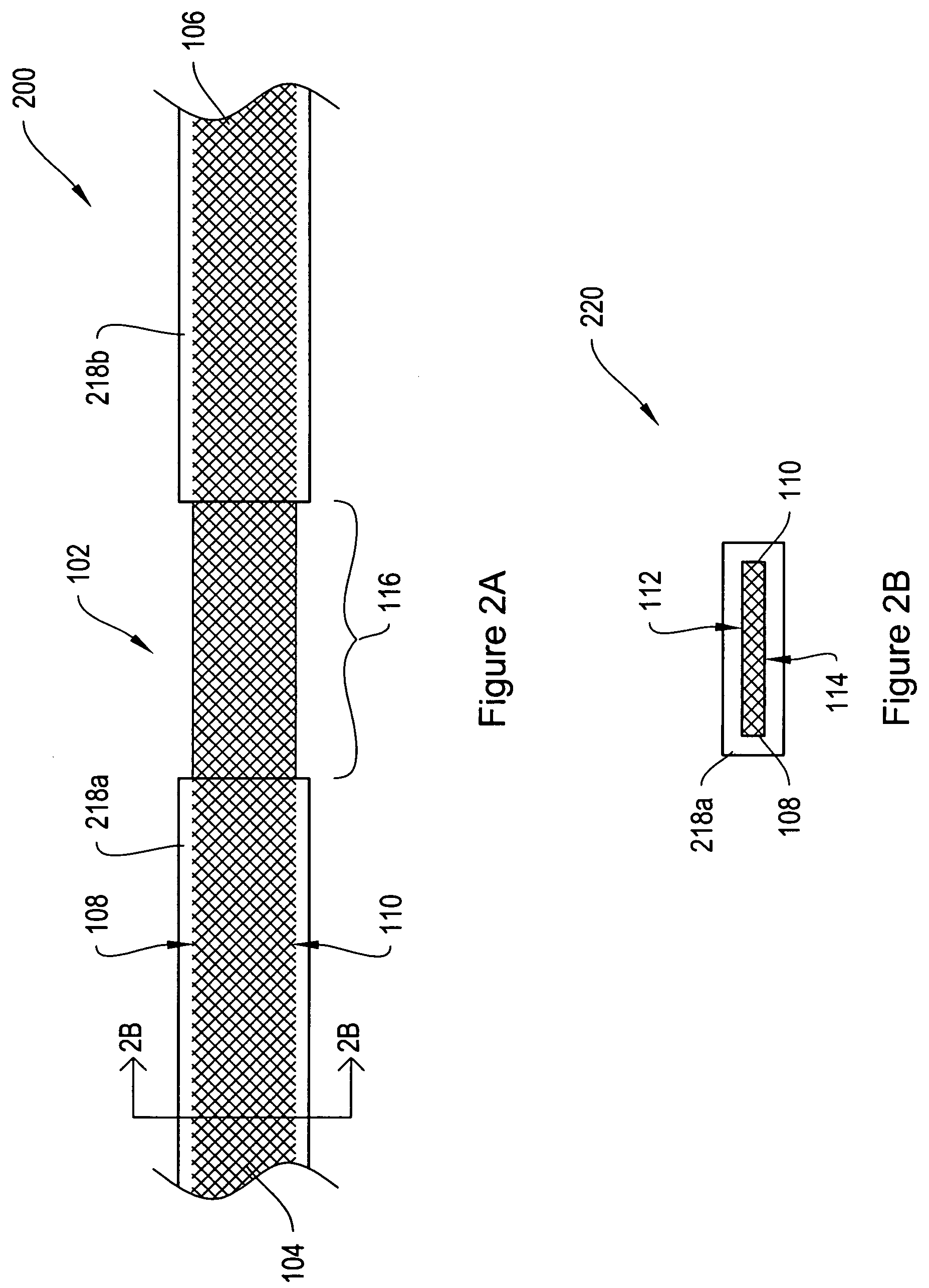 Dissolvable protective treatment for an implantable supportive sling