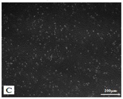 Construction method of radioactive cell damage model