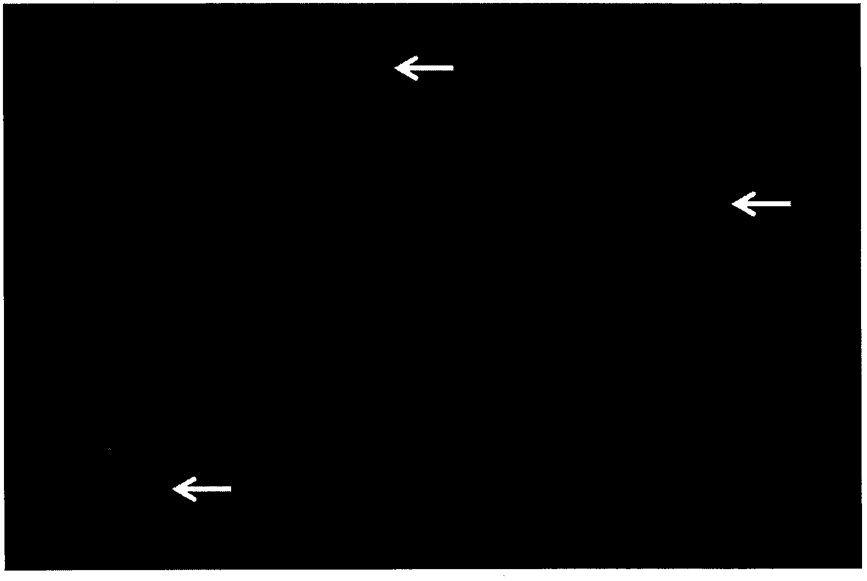 Gene probe for alveolar soft part sarcoma and application of gene probe kit