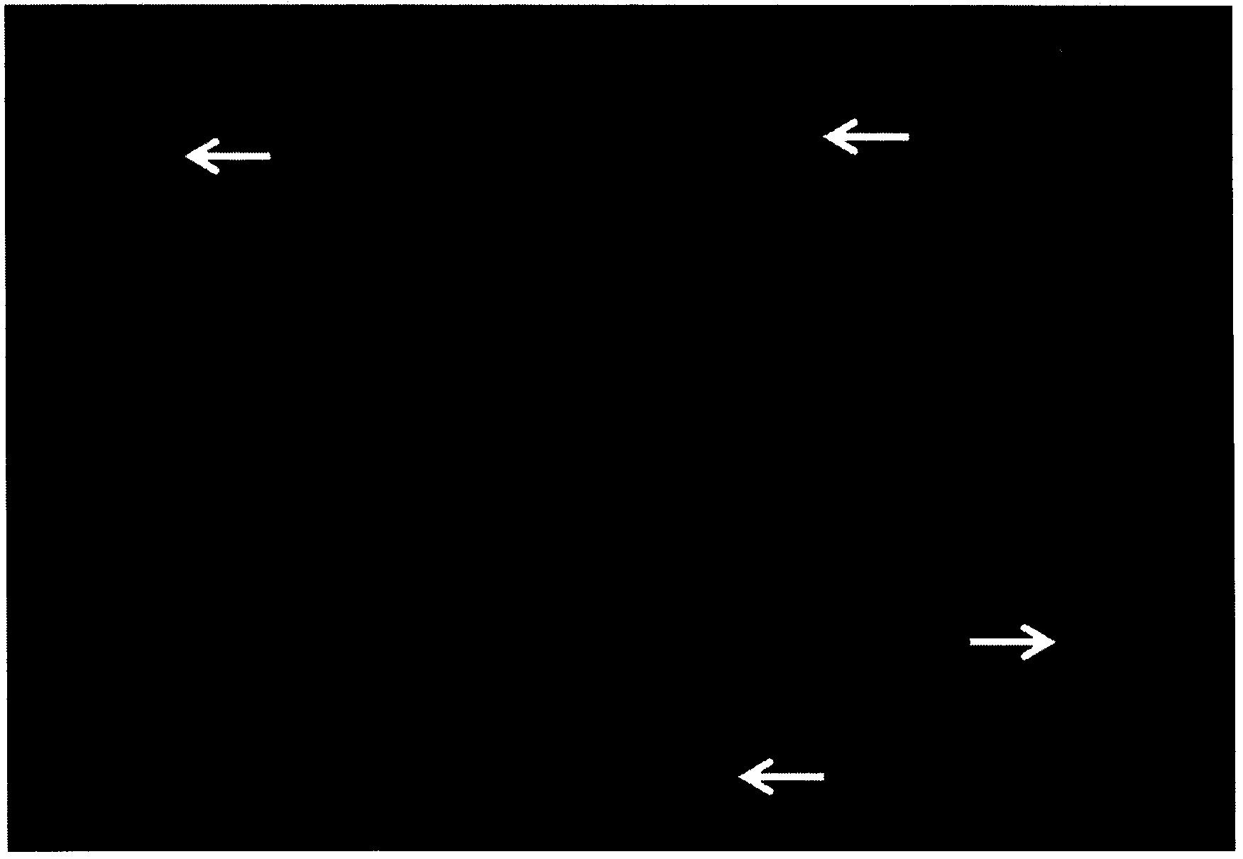 Gene probe for alveolar soft part sarcoma and application of gene probe kit