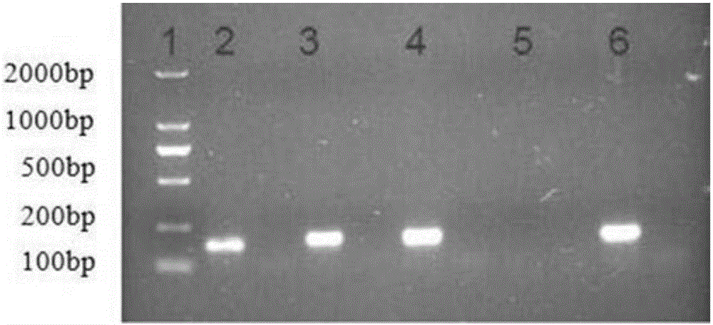 Multiple-FIA (fluorescence immunoassay) method and kit for quickly distinguishing CDV (canine distemper virus), CPV (canine parvovirus) and RV (rabies virus)