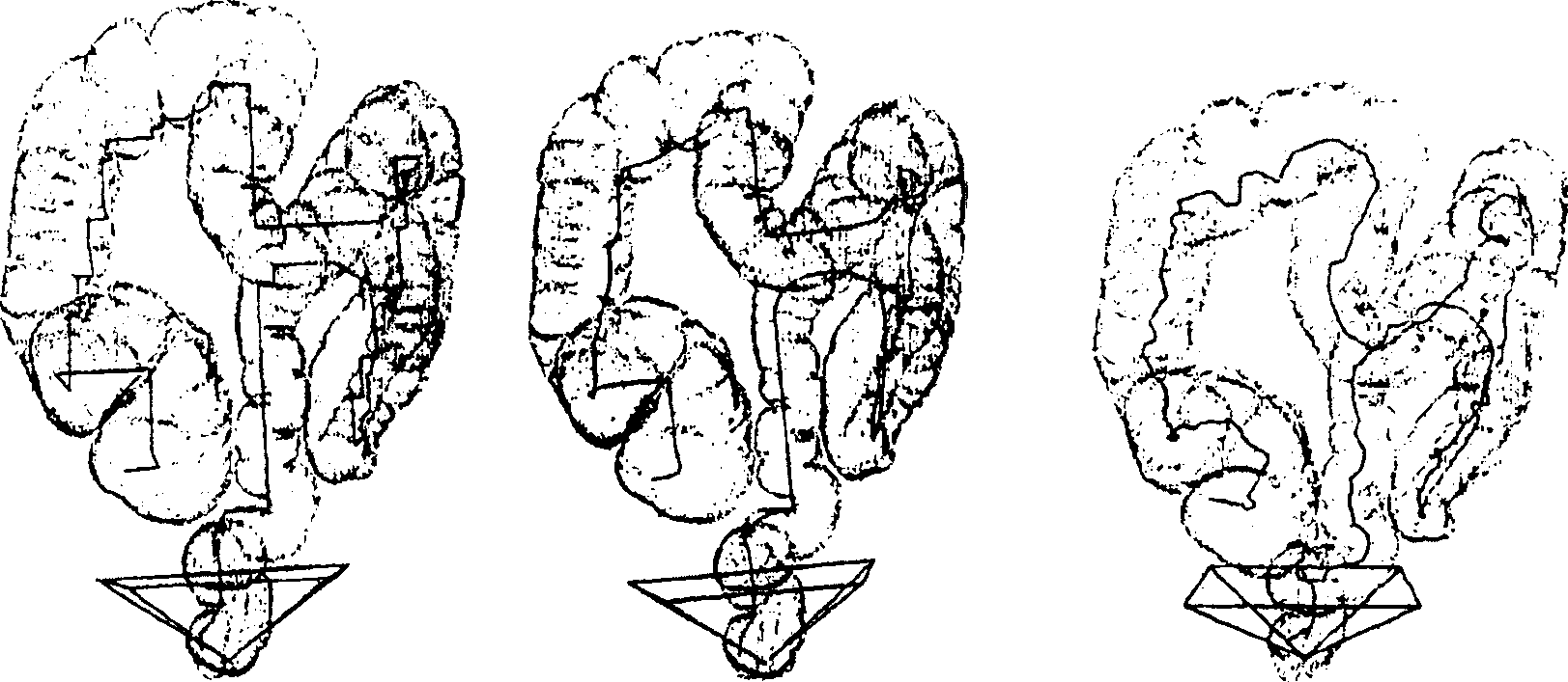 Method and apparatus for automatic local path planning for virtual colonoscopy