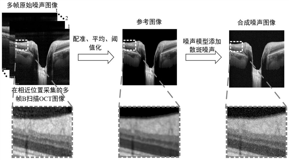 OCT Image Denoising Method Based on Dense Connections and Generative Adversarial Networks