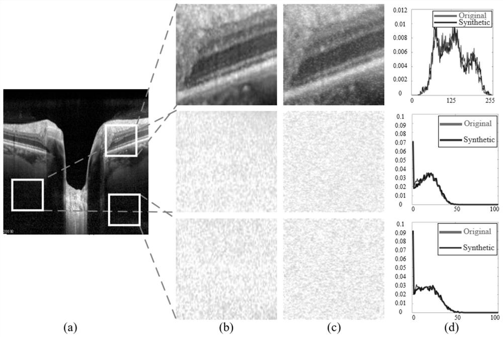 OCT Image Denoising Method Based on Dense Connections and Generative Adversarial Networks