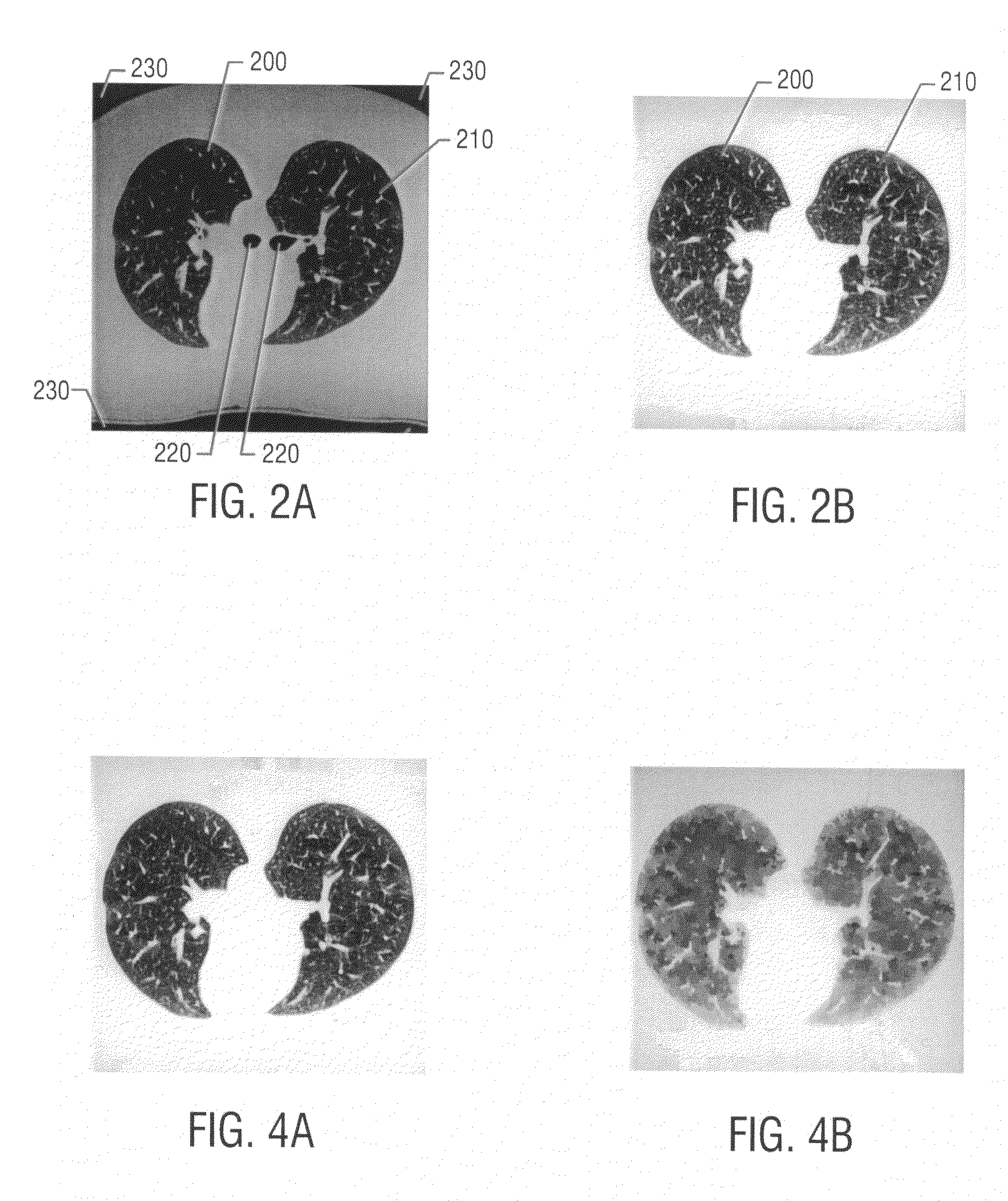 Methods and apparatuses for analyzing images