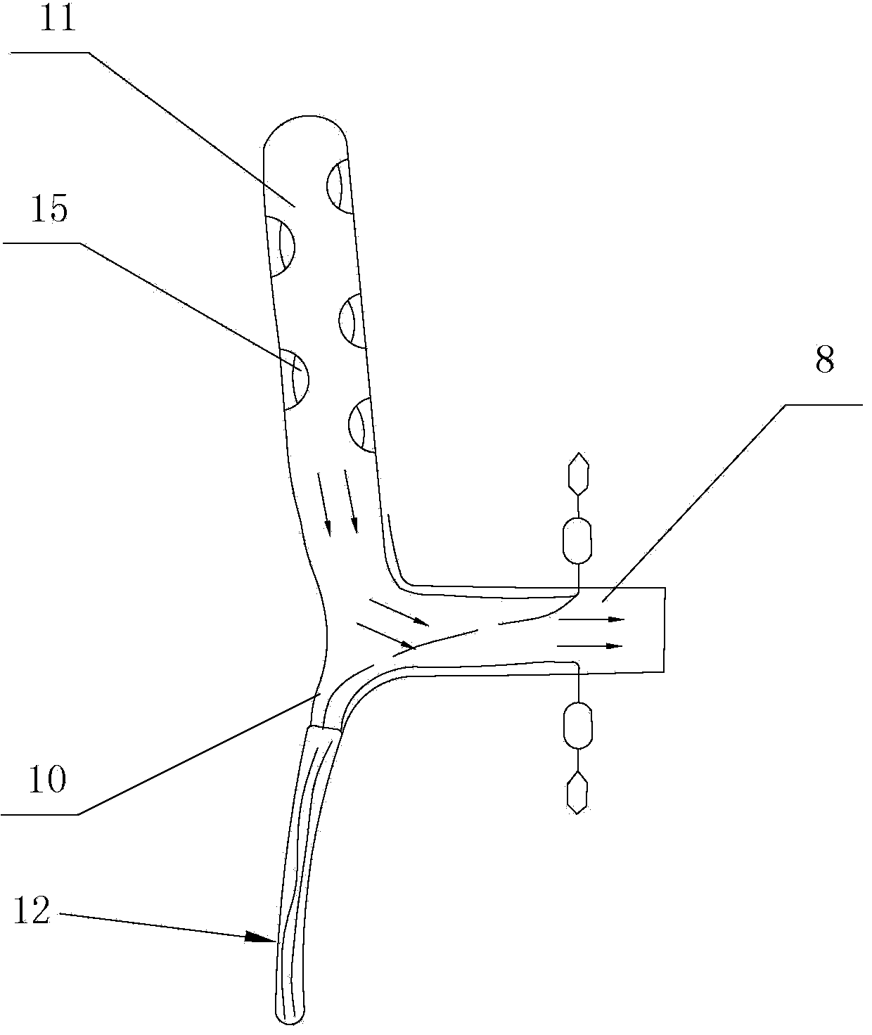 Ileum fistulization tube